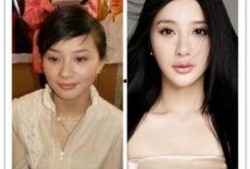 爆料女星削骨视频大全最新,女星削骨手术视频大盘点